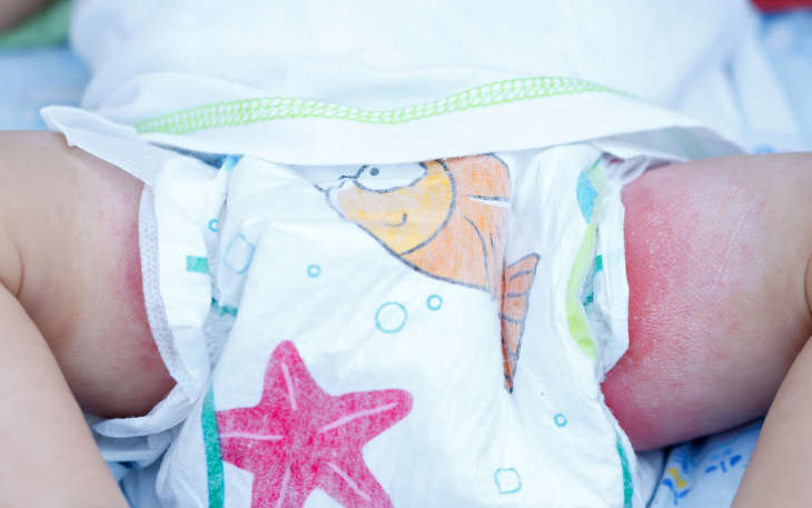 using diapers for babies is good or bad