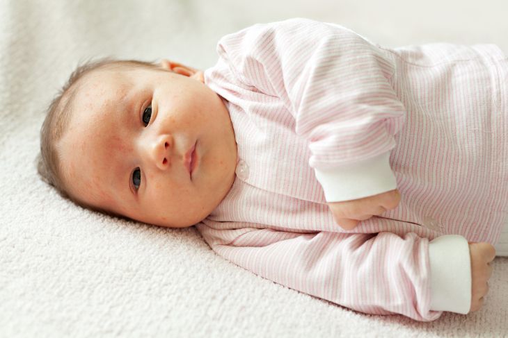 Can Babies Get A Body Rash When Teething