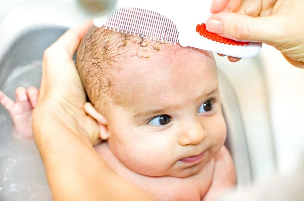 cradle cap