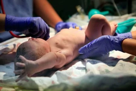 Newborn baby undergoing medical proedure