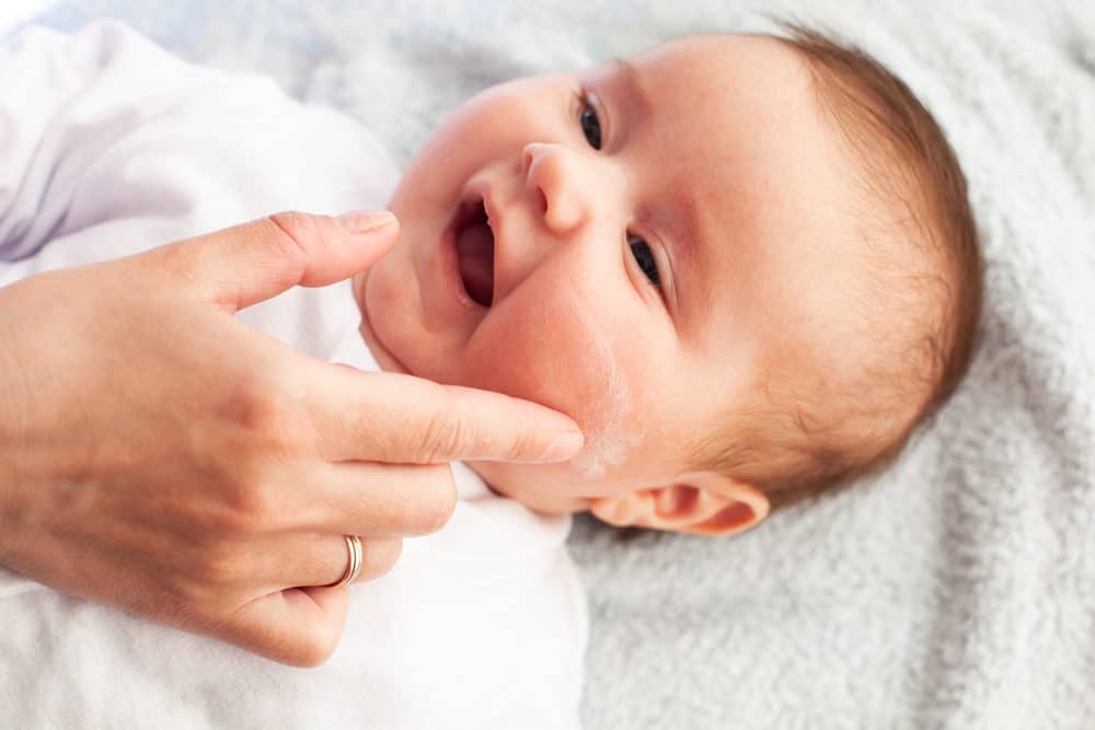 sidde molester Forkludret 10 Best Baby Eczema Creams (2023 Reviews) - Mom Loves Best
