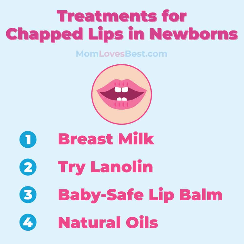 treatments for chapped lips in newborn babies